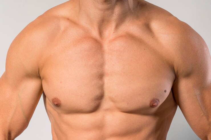 What Men Need to Know Before Having Gynecomastia Surgery?