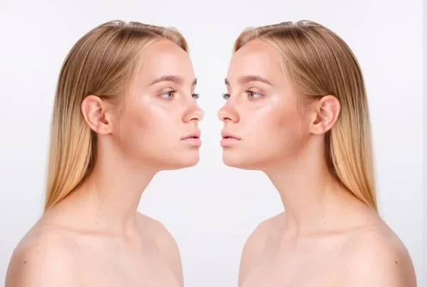 Benefits of Nose Reshaping Surgery Rhinoplasty