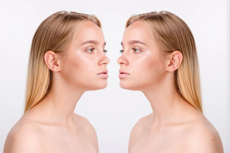 Aesthetic and Functional Benefits of Nose Reshaping Surgery