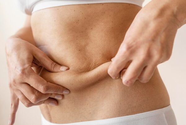 10 Questions to Ask Your Surgeon before Tummy Tuck Surgery