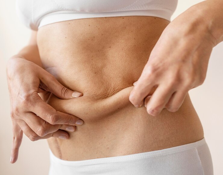 10 Questions to Ask Your Surgeon before Tummy Tuck Surgery