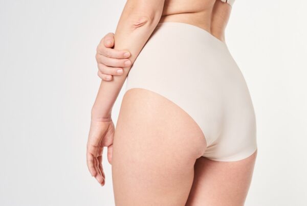 How to Choose the Right Brazilian Butt Lift Surgeon: Expert Tips