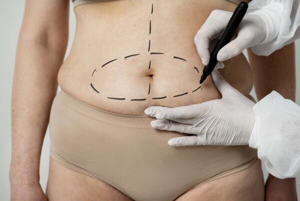 Post-Baby, Pre-Summer Why Spring Is the Perfect Time for Your Mommy Makeover