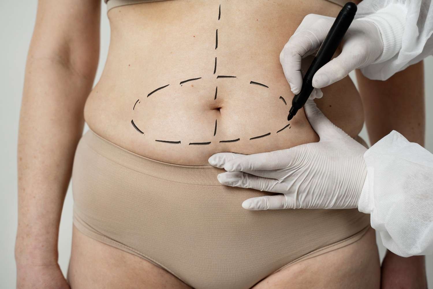Post-Baby, Pre-Summer: Why Spring Is the Perfect Time for Your Mommy Makeover